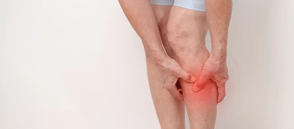 Woman experiencing calf pain, a common symptom of deep vein thrombosis