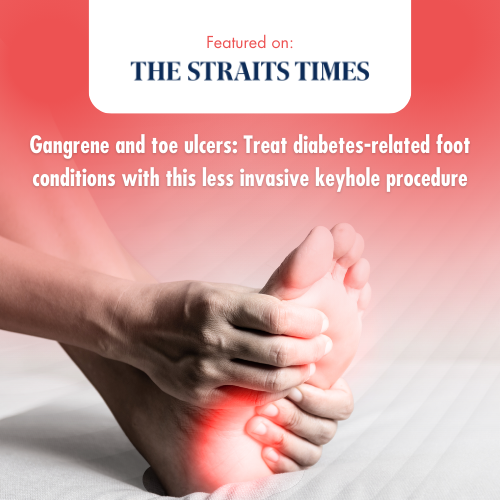 Diabetes-related foot conditions
