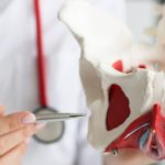 pelvic congestion syndrome