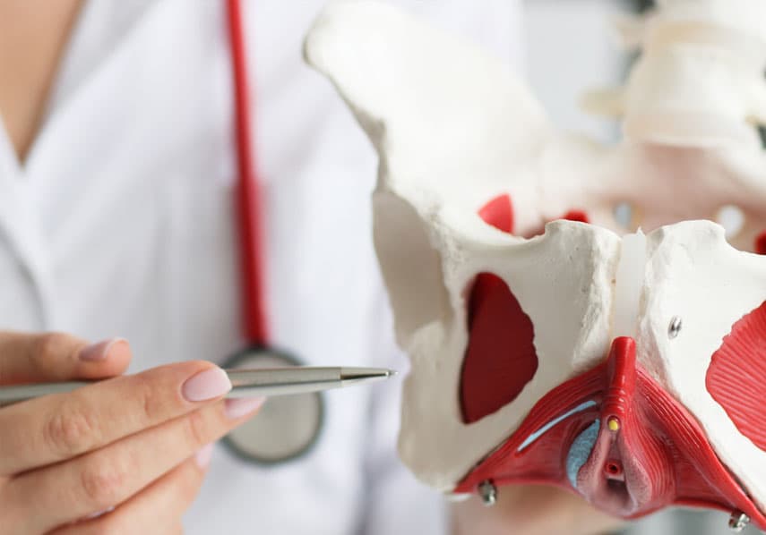 pelvic congestion syndrome