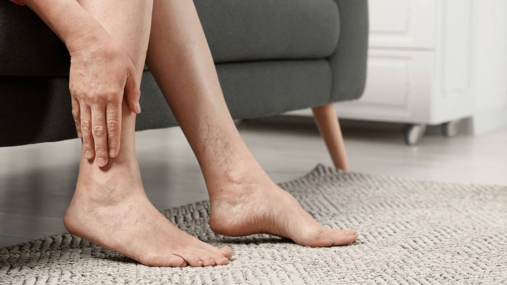 Chronic Venous Insufficiency Symptoms