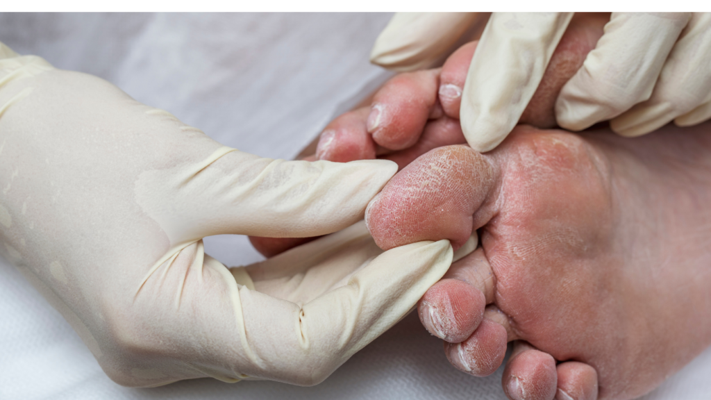 Keyhole Procedures for Diabetes