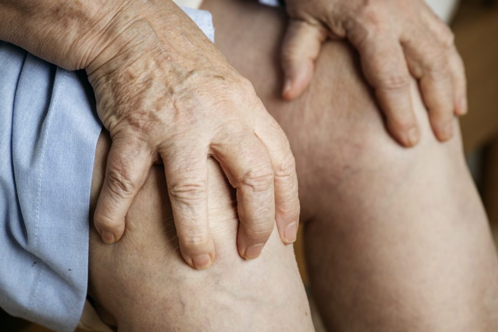Varicose Vein Relief