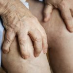 Varicose Vein Relief