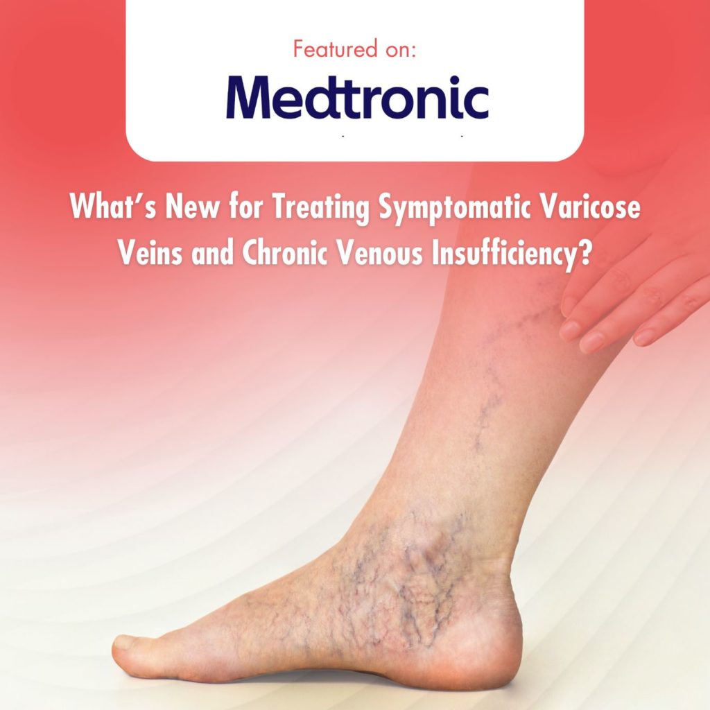 's New For Treating Symptomatic Varicose Veins And Chronic Venous Insufficiency