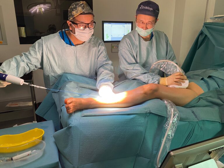 Venaseal procedure banner