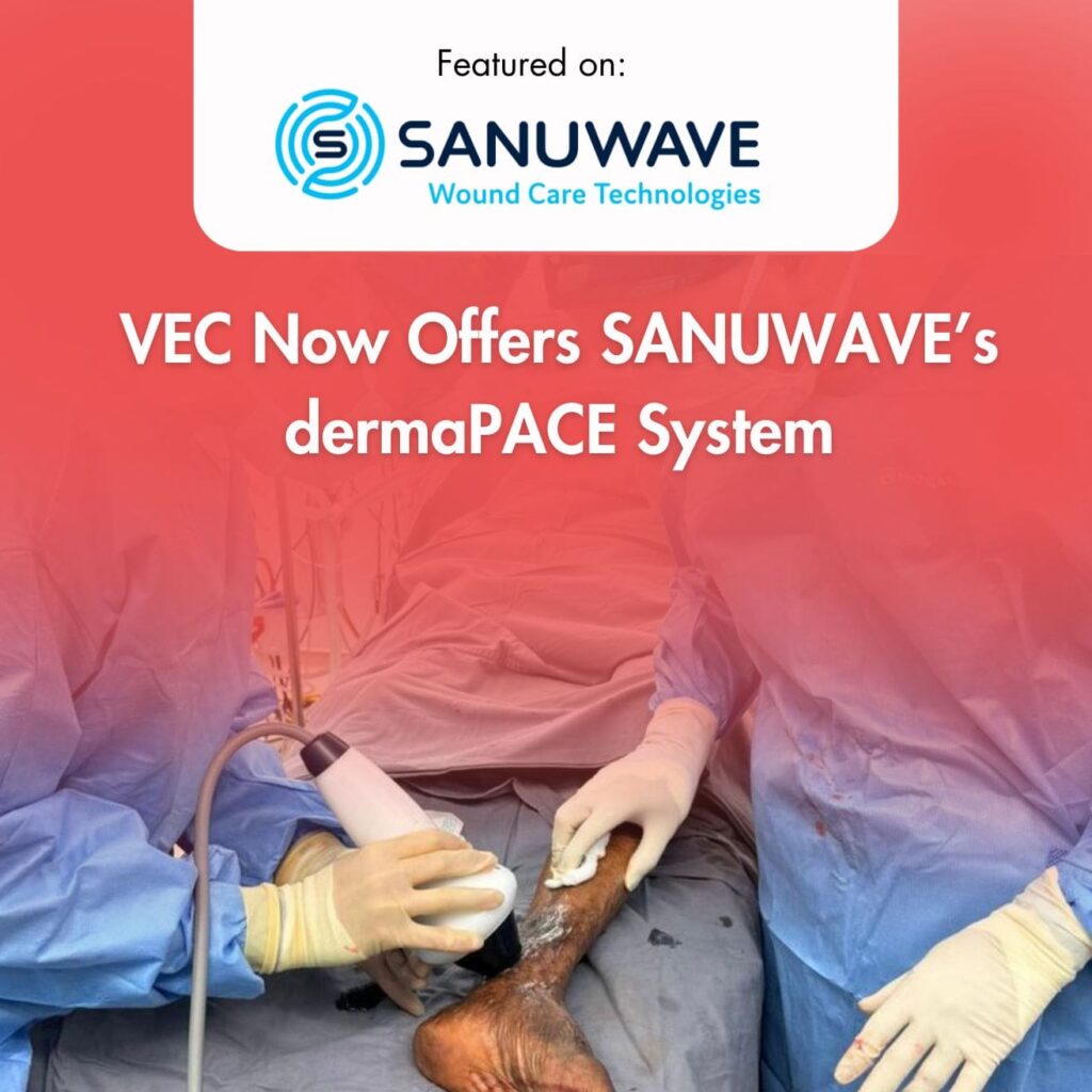 SANUWAVE dermaPACE System