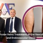 Varicose Veins Treatment at theVascular and Endovascular Clinic