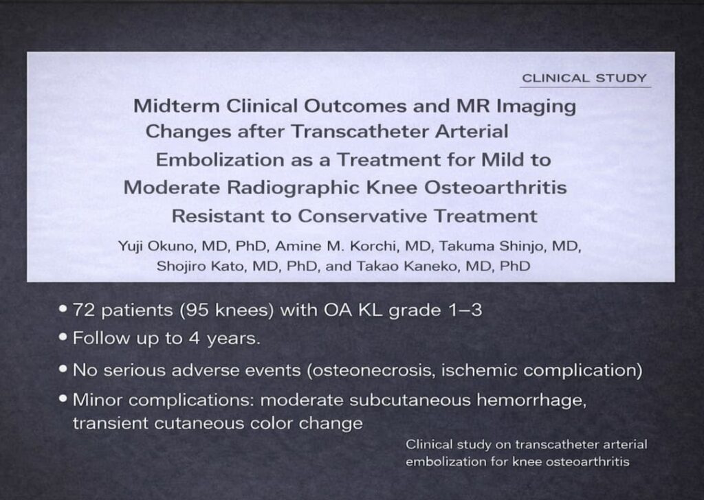Clinical study of Transcatherer Arterial Embolisation for knee osteoarthritis